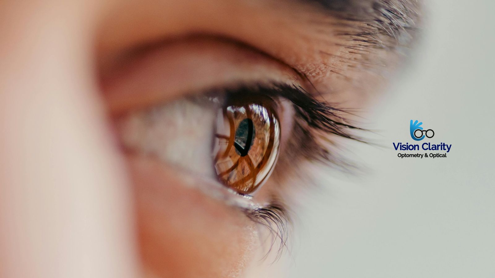 Is dry eye treatment covered by OHIP?